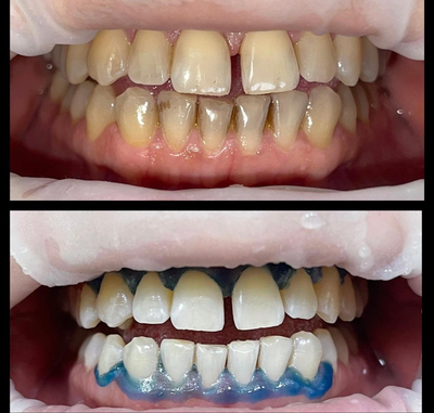 Улыбайтесь чаще! Стоматология «SMILE FOR YOU» дарит скидку до 40% Улыбайтесь чаще! Стоматология «SMILE FOR YOU» дарит скидку до 40%